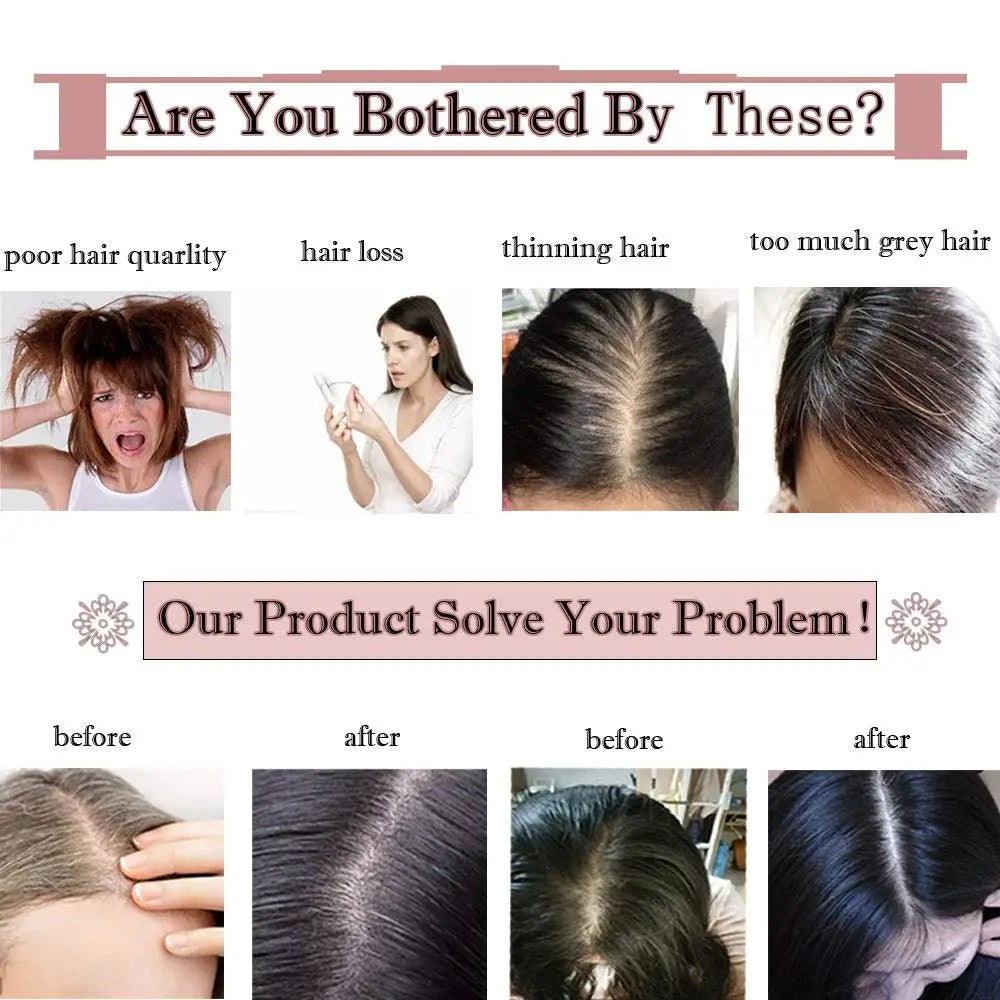 11x13cm Dark Brown Human Hair Topper Silk Base Hand Tied Silk Top Toupee Breathable Remy Hair Piece with Clips in for Women